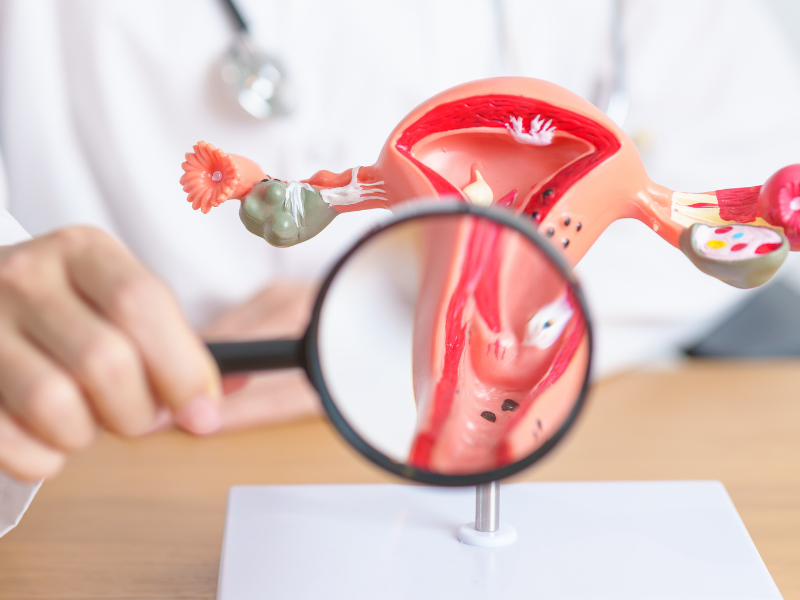 Vajinoplasti Ameliyatı